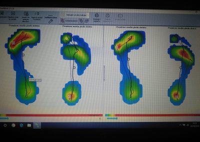 Casi clinici fisioterapia Avellino Napoli