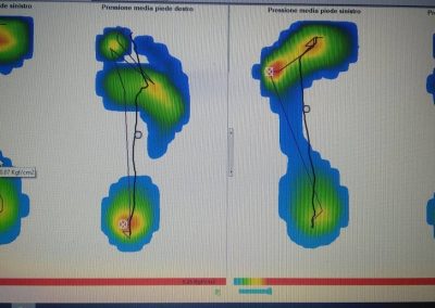 Fisioterapia Avellino casi clinici