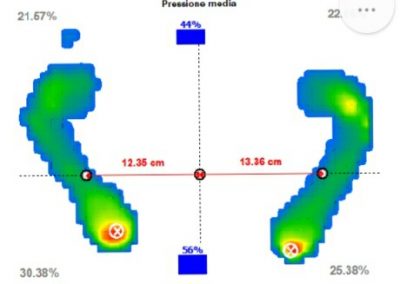 Casi clinici fisioterapia Avellino