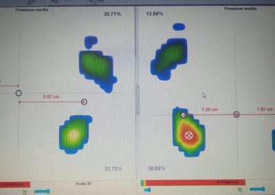 Fisioterapia Avellino Casi clinici