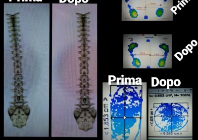 Casi clinici fisioterapia Avellino